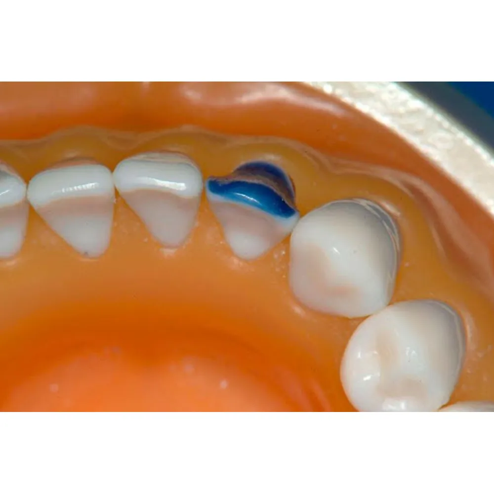 maarc inlay/onlay wax sticks maarc inlay/onlay wax sticks